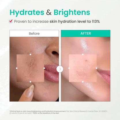 Dr. G Brightening Peeling Gel - Korean Skincare for Glowy Skin - Aqua Gommage Facial Exfoliator - Hyaluronic Acid, Ceramides, Vitamin C - Smooth Skin Texture, Low Irritation - Bulk Items - 4.23 fl oz