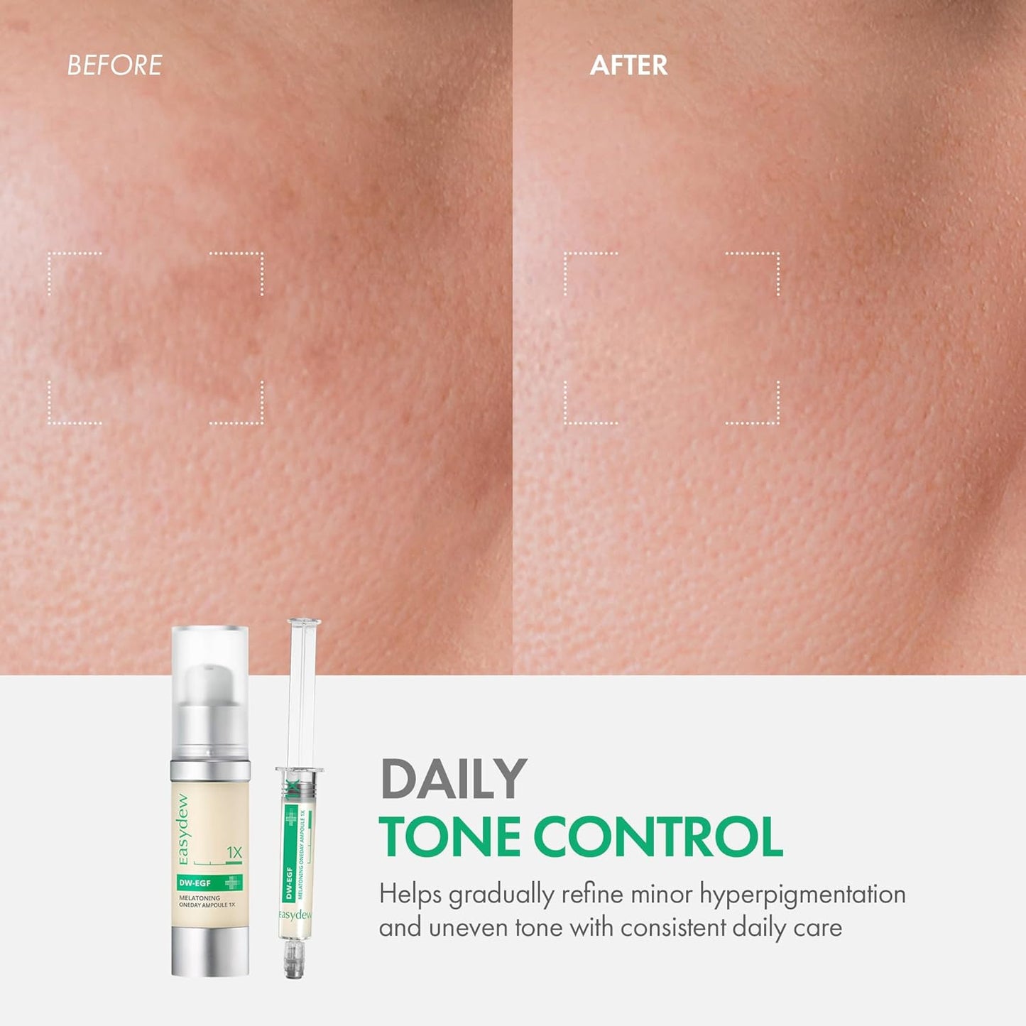 Easydew DW-EGF Melatoning Ampoule 1X - Зволожуюча сироватка від темних плям з ніацинамідом та глутатіоном для нерівної шкіри - Швидкопоглинаюча денна та нічна ампульна корейська косметика для догляду за шкірою (дозатор 0.27 рідкої унції, EGF 1X) 