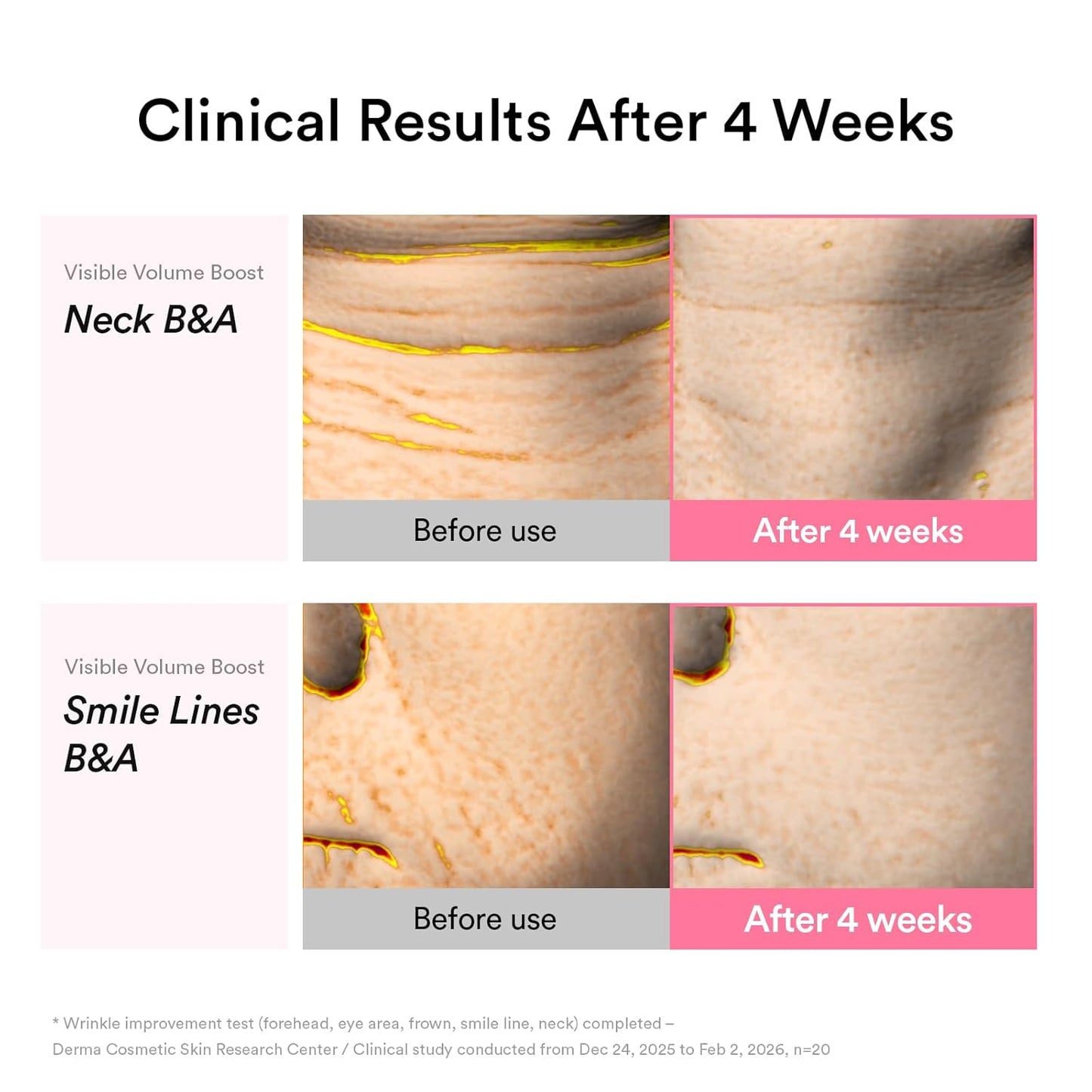 Abib PDRN Volume fill-it Booster Cream 2.5 tube | Facial Volume Plumping with PDRN 15,000ppm Peptides Retinal