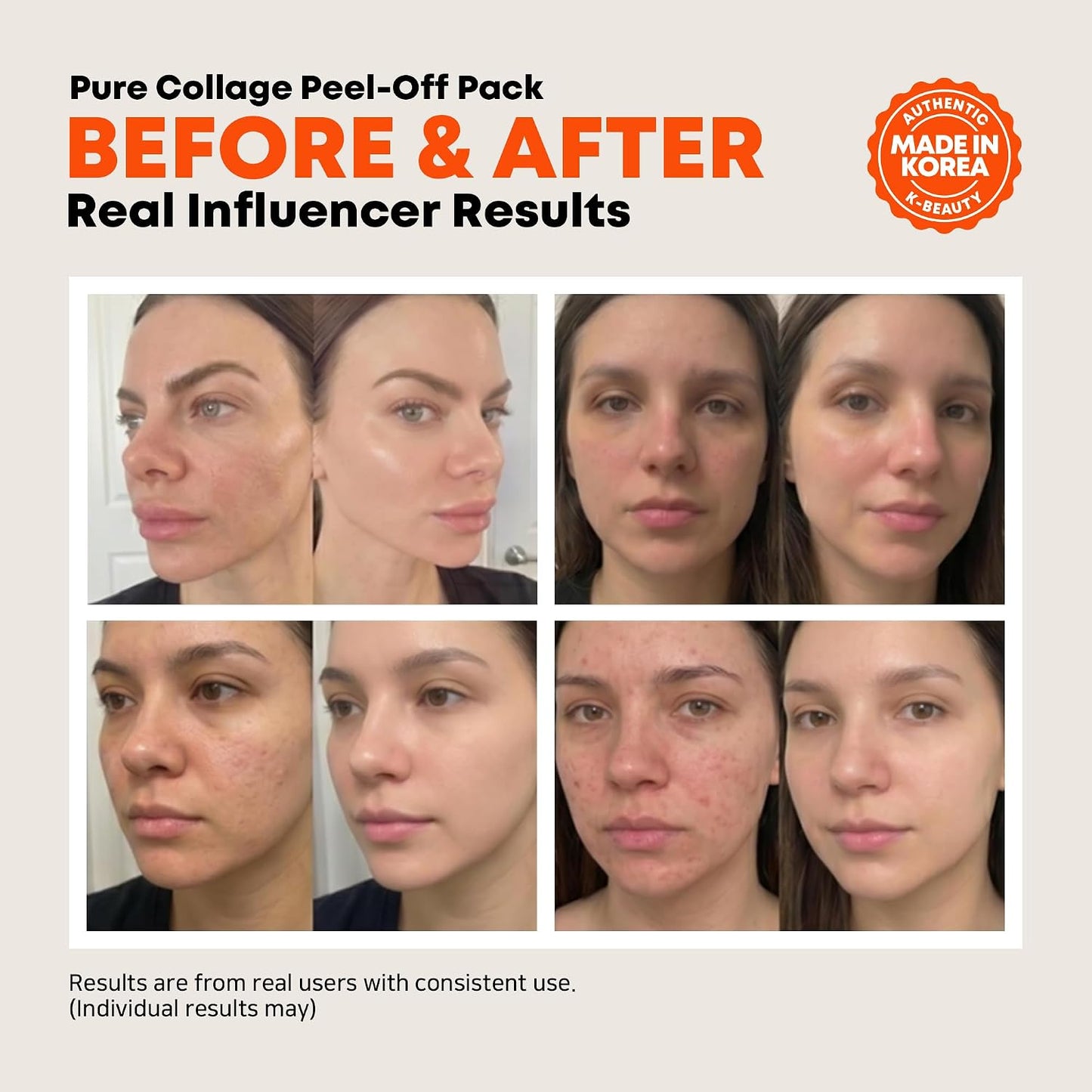 ELT Collagen Peel Off Face Mask Pack, Silicone Brush Included (60 ml / 2.02 fl.oz)